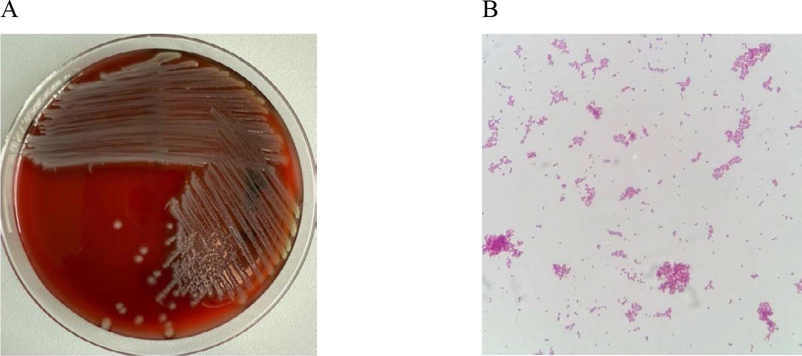 In vitro cultures of Escherichia coli on Columbia Agar with 5% sheep blood (A) and a Gramstained preparation of Escherichia coli viewed under a light microscope (magnification x1000). Source: own elaboration.