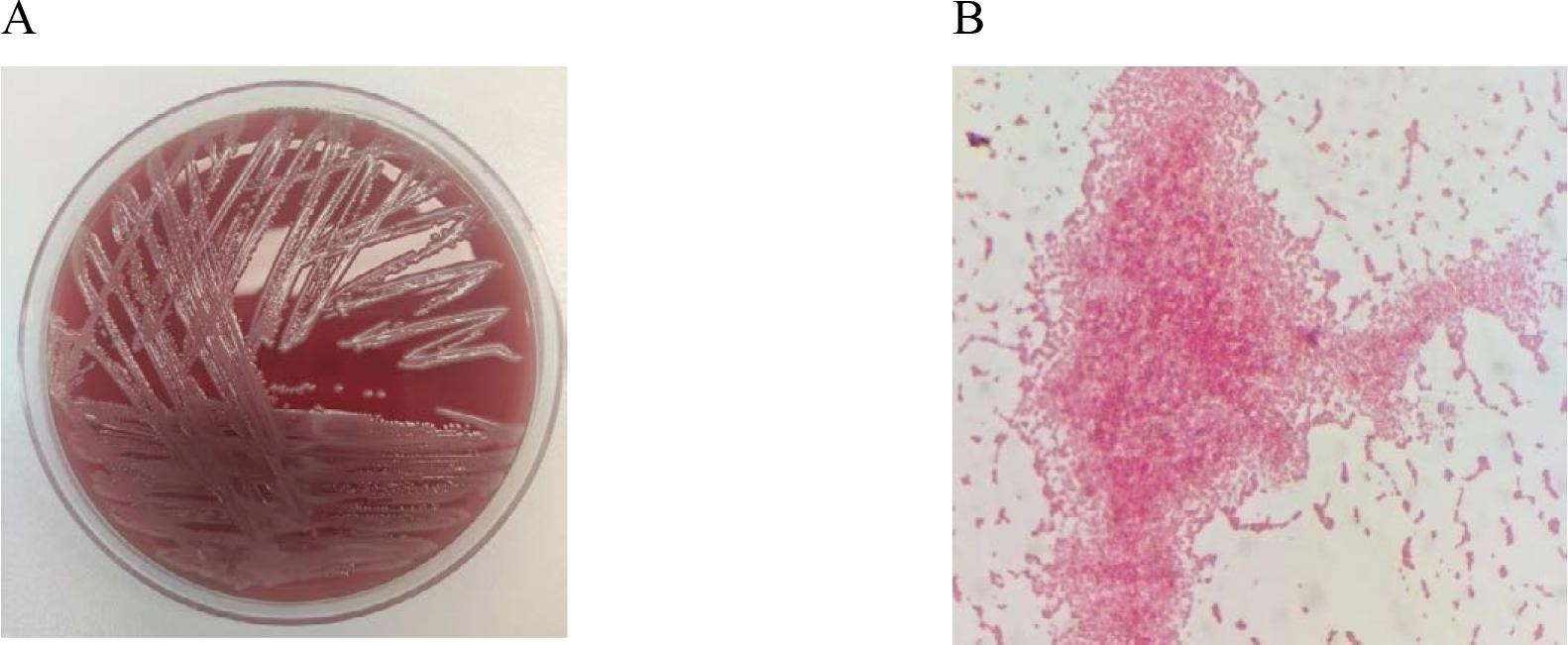 In vitro cultures of Acinetobacter baumannii on Columbia Agar with 5% sheep blood (A) and a Gram-stained preparation of Acinetobacter baumannii viewed under a light microscope (magnification x1000). Source: own elaboration.