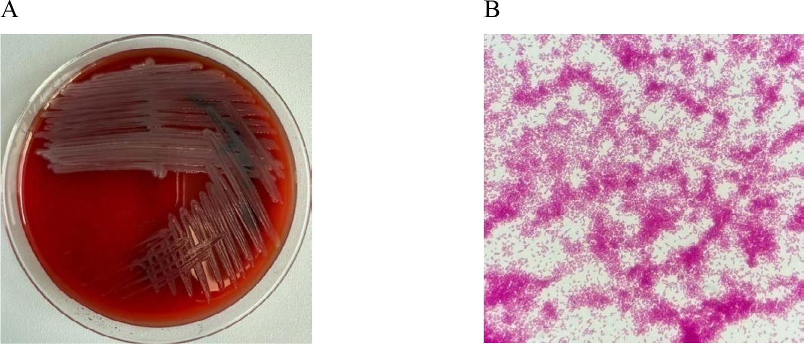 In vitro cultures of Pseudomonas aeruginosa on Columbia Agar with 5% sheep blood (A) and a Gram-stained preparation of Pseudomonas aeruginosa viewed under a light microscope (magnification x1000). Source: own elaboration.