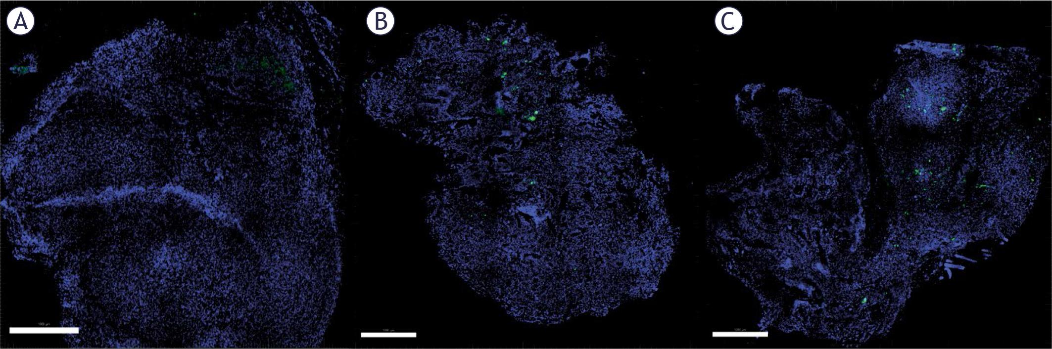 Transfection of B16F10 tumors. Untreated control tumors (A), GET2 (B) and GET4 (C) tumors. Nuclei are stained blue with Hoechst. The transfected cells are presented in green, indicating transfection with the GFP plasmid.
Scale bar = 1000 μm