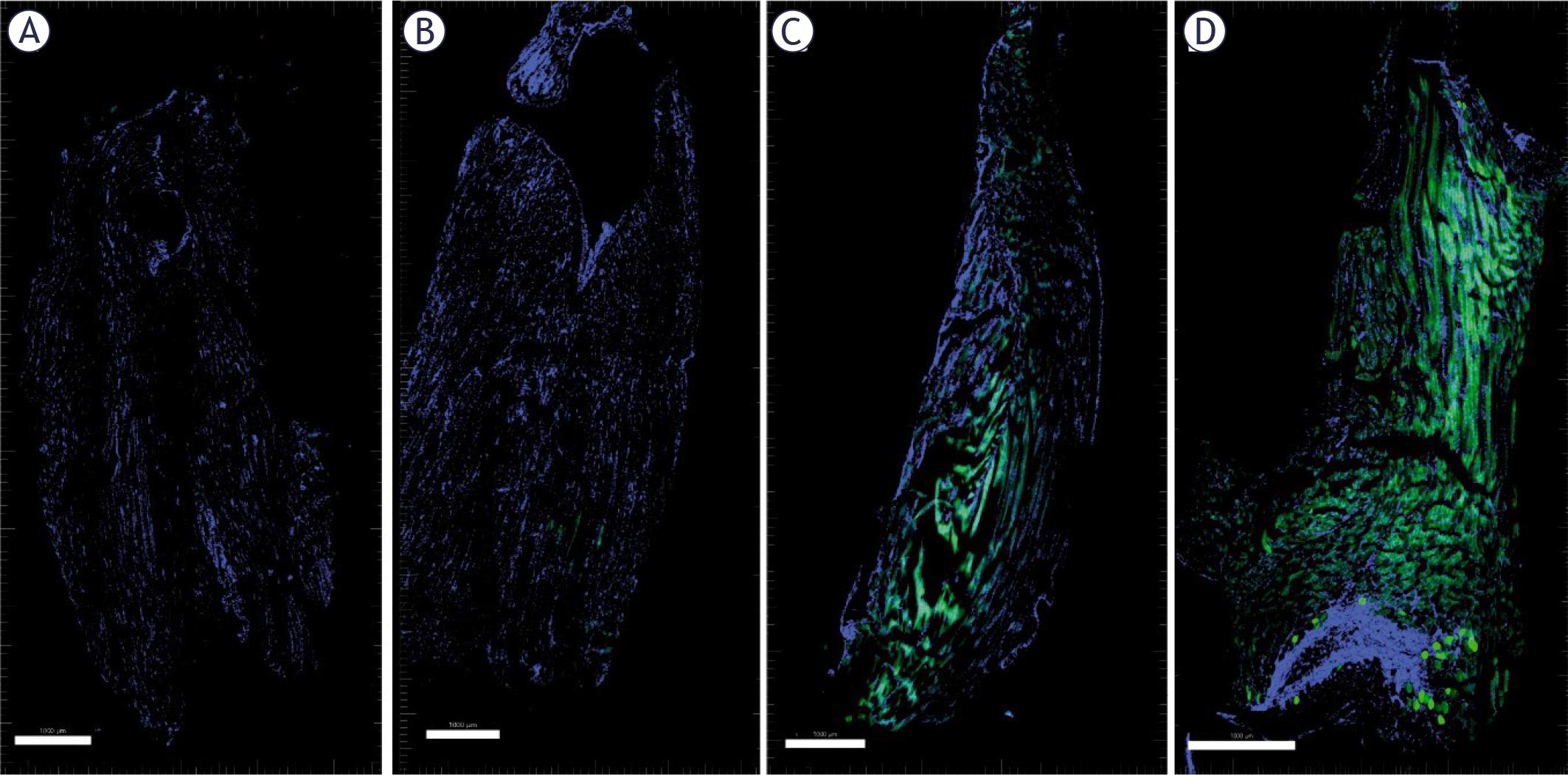 Transfection of muscle. Control (A), GET2 (B), GET4 (C) and 1HV-4LV (D). The nuclei are stained blue with Hoechst. The transfected cells are presented in green, indicating transfection with the GFP plasmid.
Scale bar = 1000 μm.