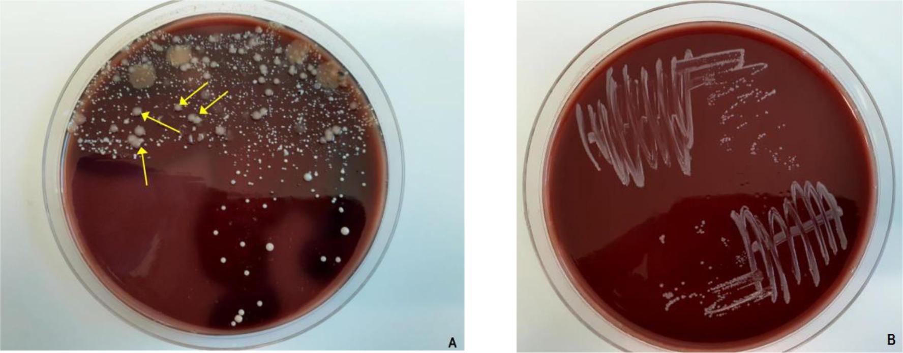 Growth of Taylorella equigenitalis on chocolate agar. A) colonies (indicated by arrows) among mixed cultures of bacteria grown in direct inoculations from urogenital swabs of stallions onto agar. B) isolated cultures