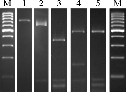 Electrophoresis of PCR-RFLP products. Lanes: 1 SG-749; 2–5 restriction patterns A, B, C and D; M – molecular weight standard
