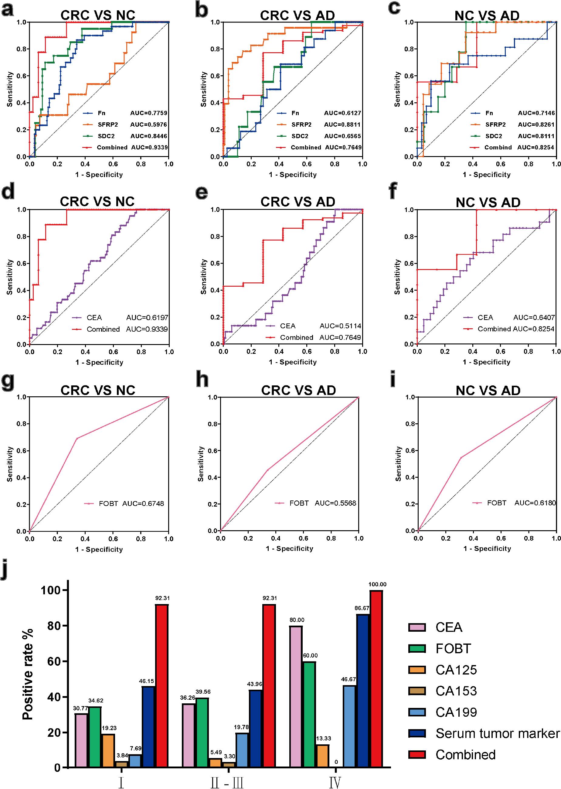 Diagnostic performance of combined detection, single-gene detection, CEA, and FOBT.
ROC curves illustrating the sensitivity and specificity of SFRP2, SDC2, Fn (fadA + nusG), CEA, FOBTand combined indicators in CRC vs. NC (a, d, g), CRC vs. AD (b, e, h), and NC vs. AD (c, f, i) in fecal samples, along with their corresponding AUC values. Positive rates of four CRC biomarker combination indicators, FOBT, and serum tumor markers in CRC stages I, II, III, and IV (j).