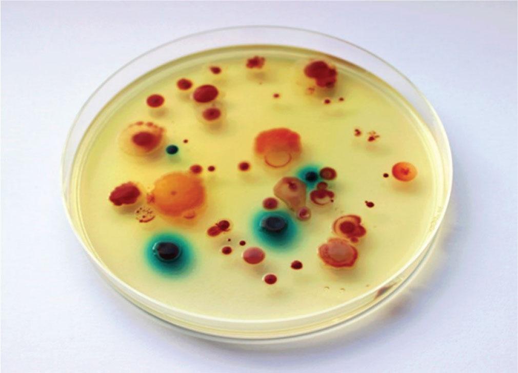 Carbapenem-resistant bacterial species from river sediment cultured on CHROMagar Acinetobacter. Red – Acinetobacter spp., Pseudomonas sp., and Stenotrophomonas sp. (similar to Acinetobacter but of different morphology). Blue – Enterobacterales