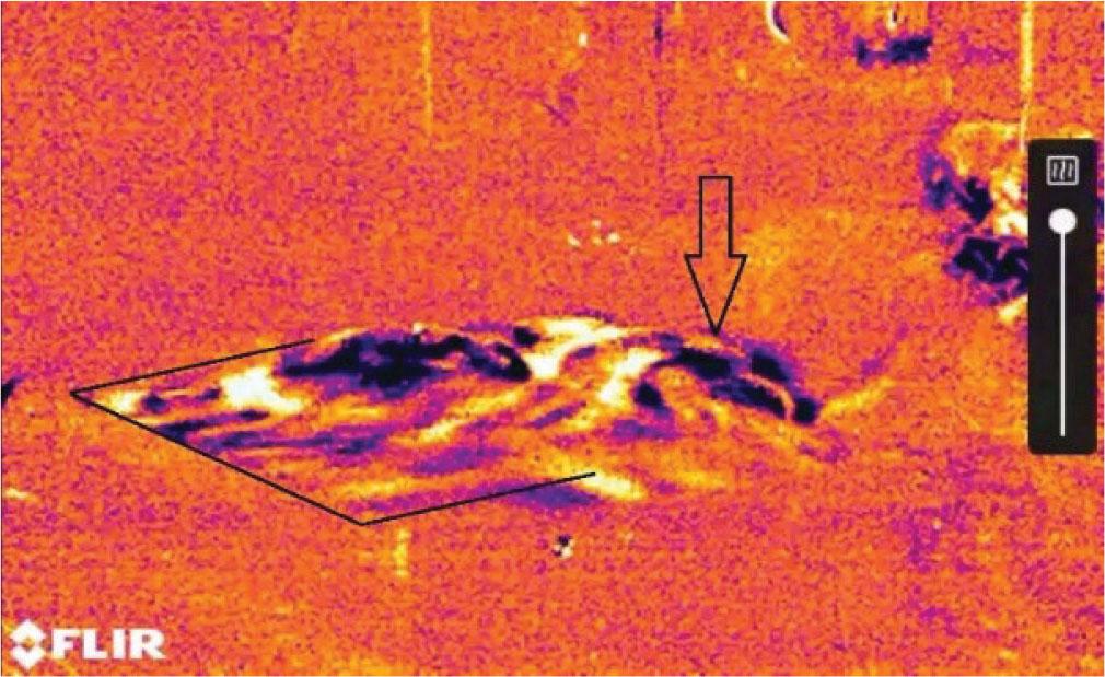 Movement of formalin vapour (black arrows) by the grossing station ventilation system recorded with the optical gas imaging camera