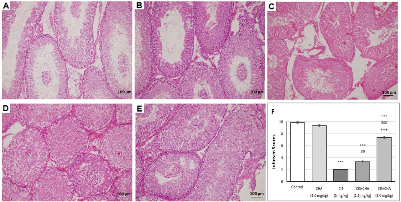 Effects of CHA (1.5 and 3 mg/kg) on testicular tissue architecture in CIS-treated rats (200×). A) control; B) CHA alone (3 mg/kg); C) CIS (5 mg/kg); D) CIS+CHA (1.5 mg/kg); E) CIS+CHA (3 mg/kg); F) Mean Johnsen scores for all groups. Data are presented as means ± SEM. ***p<0.001 – significant difference from control; ##p<0.01 and ###p<0.001 – significant difference from the CIS alone group; +++p<0.001 – significant difference from the CIS+CHA (1.5 mg/kg) group. CHA – chlorogenic acid; CIS – cisplatin; SEM – standard error of the mean