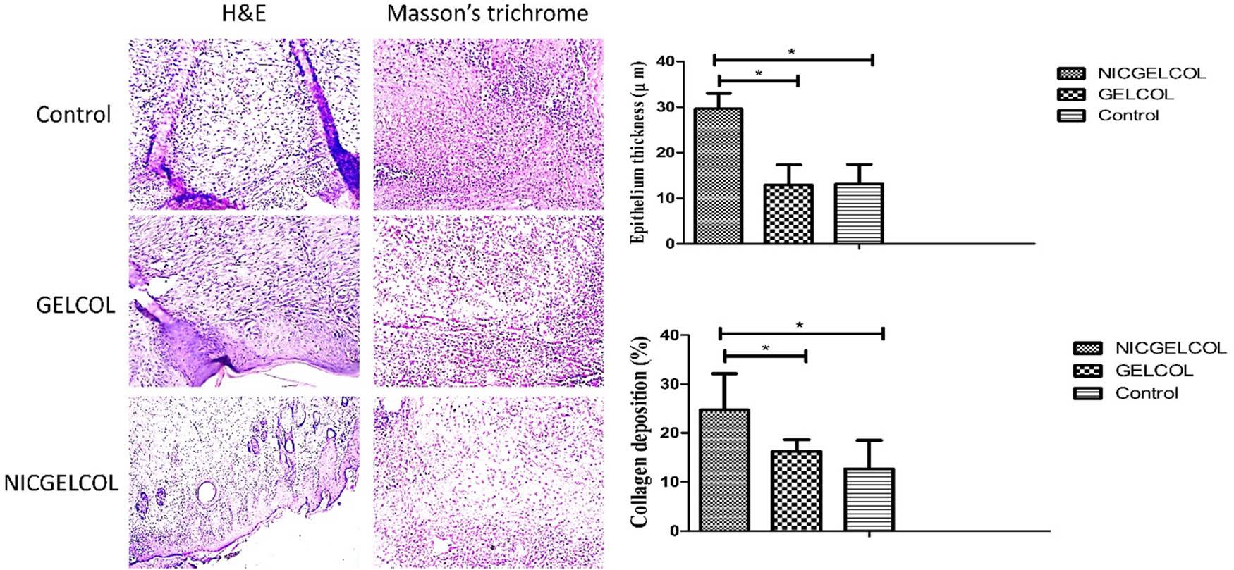 Histopathological studies in diabetic wounds treated with NICGELCOL and GELCOL sponges and histomorphometric analysis. * shows p-value <0.05.
