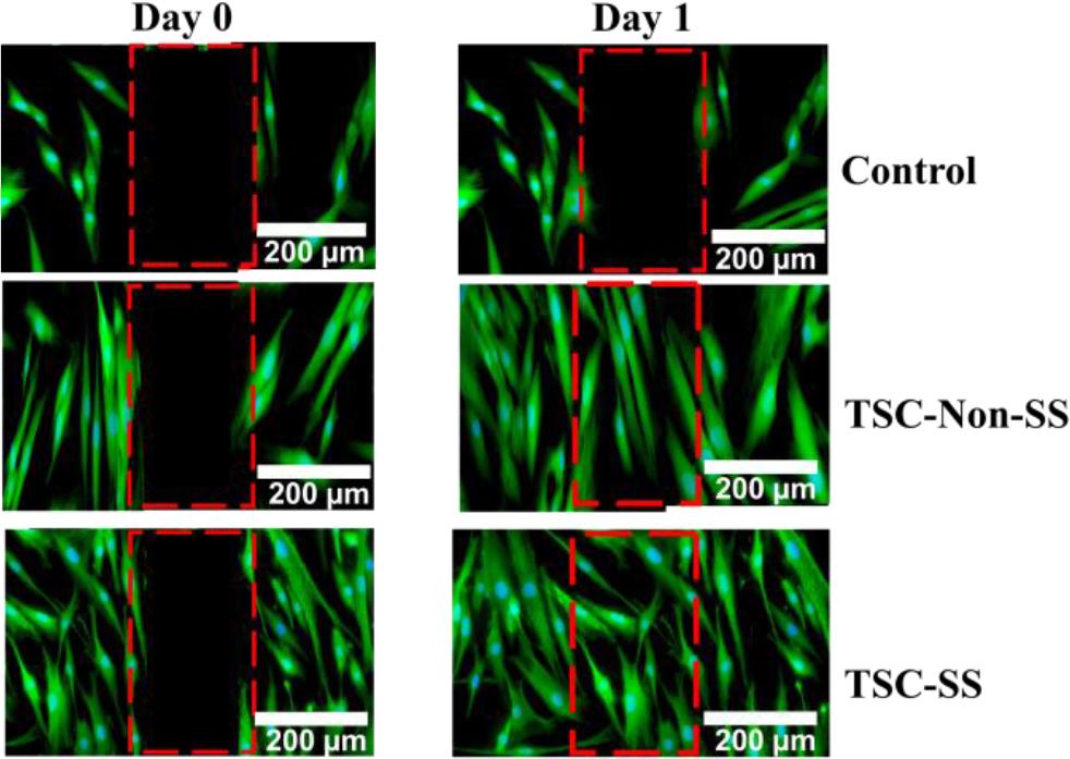 In vitro cell culture, strain-stiffening polyampholyte (TSC-SS), nonstrain-stiffening polyampholyte (TSC-Non-SS) and control induce motility in HDF-a cells after 1 day. Scale bar = 200 μm