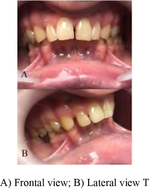 Initial oral examination.