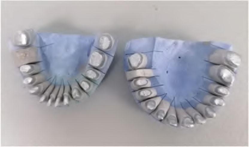 Working maxillary (right) and mandibular (left) casts