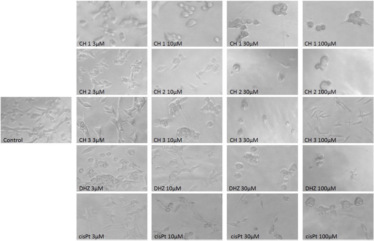 Morphology of the HeLa cells after 48 h treatment with investigated substances. Equal number of HeLa cells were plated in 24 well plates and allowed to attach for 24 h. Cells were exposed to vehicle (VEH)-containing complete media and different concentrations of CH, DHZ and cisplatin during 48 h period and morphology of the cells was analysed on microscope.