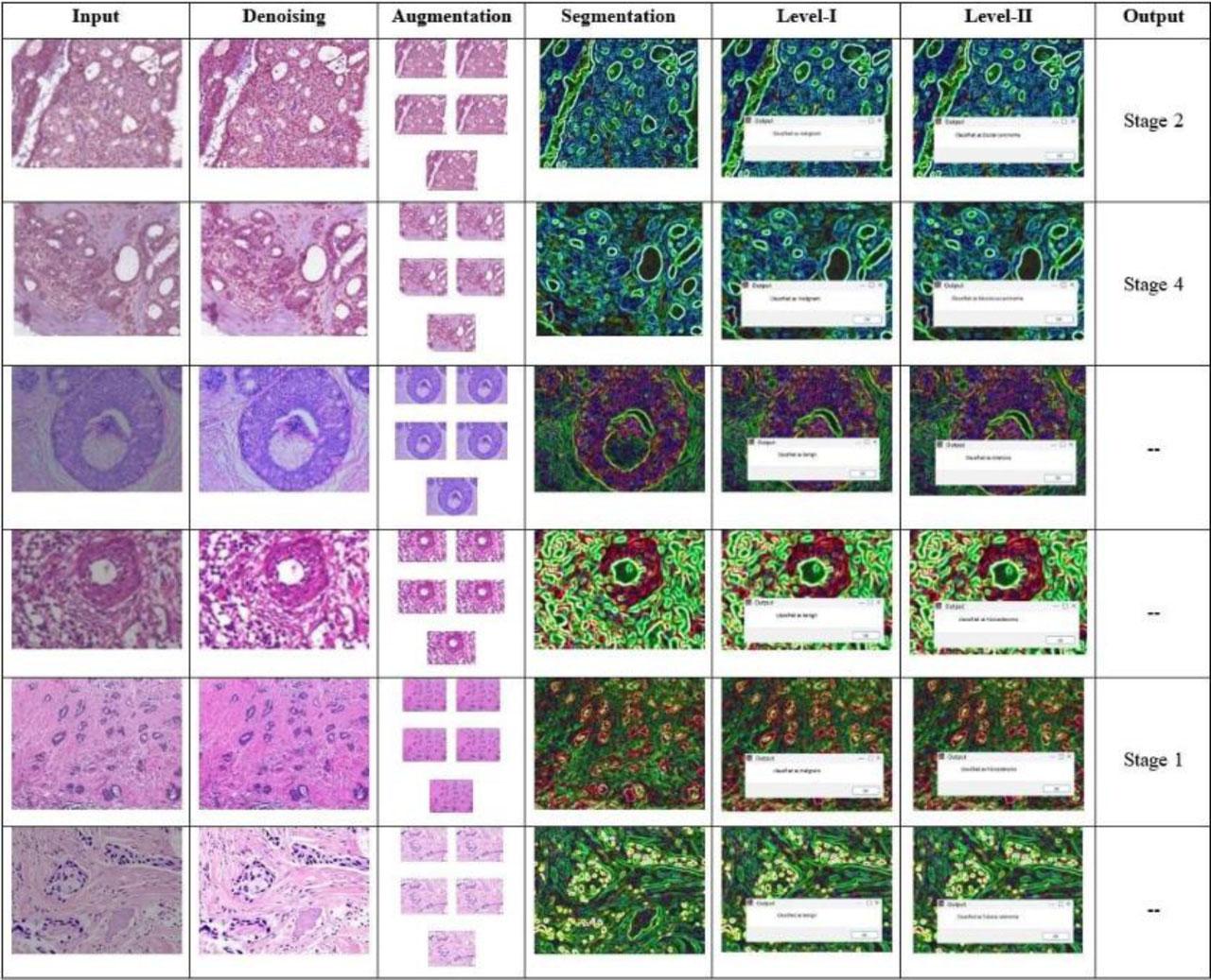 Experimental results of the proposed TRI-BCC model for BC classification.