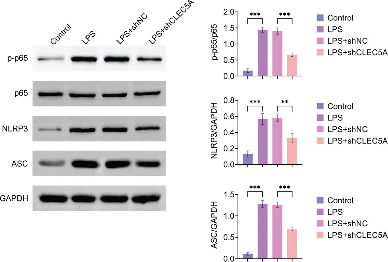 CLEC5A knockdown can block the activation of NF-κB/NLRP3 signaling pathway. Western blotting to detect p65, p-p65, NLRP3, ASC protein expression. Values are presented as mean ± SD. **p < 0.01, ***p < 0.001. n = 3. ASC, CLEC5A, C-type lectin domain family 5 member A; LPS, lipopolysaccharide; NLRP3, NLR Family, Pyrin Domain Containing Protein 3; SD, shNC.