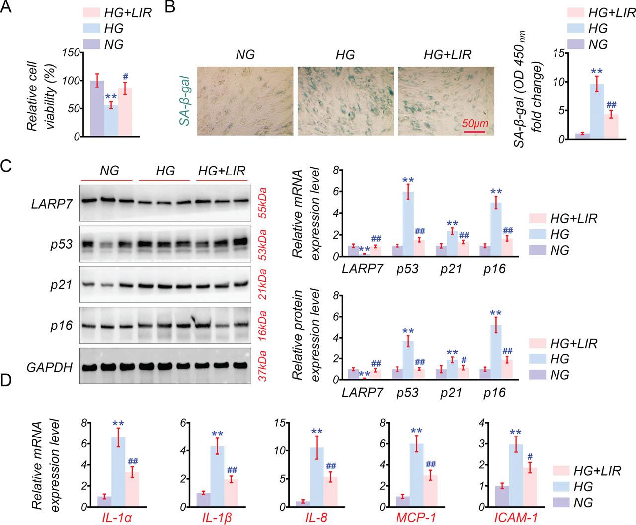 LIR augments LARP7 expression and inhibits HG-induced HUVEC senescence. Cells were categorized into four groups: NG group (5.5 mM glucose), HG group (30 mM glucose), and HG + LIR group (30 mM glucose, 500 μM LIR). (A) CCK-8 assay to assess cell viability. (B) SA-β-gal staining to evaluate cellular senescence. (C) Western blot and qPCR analysis for changes in LARP7, p53, and p21 expression levels. (D) qPCR to quantify SASP gene expression levels of IL-1α, IL-1β, IL-8, MCP-1, and ICAM-1. n = 3 for each group. Scale bar: 50 μM. **p < 0.01 vs. NG, #p < 0.05, ##p < 0.01 vs. HG. HG, high glucose; HUVECs, human umbilical vein endothelial cells; LIR, Liraglutide; MCP-1, motif chemokine ligand 2; SASP, senescence-associated secretory phenotype.