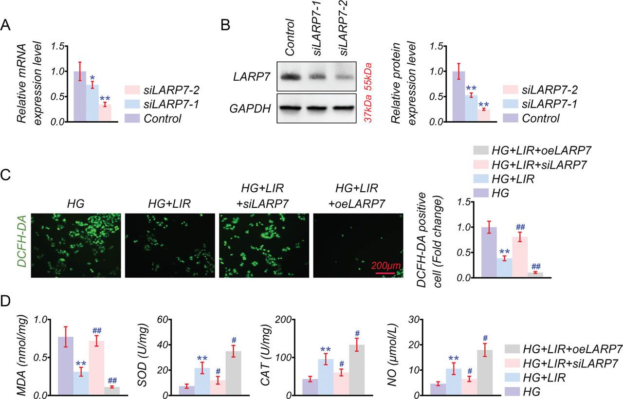 LIR alleviates oxidative stress in senescent ECs via LARP7. Two distinct LARP7 knockdown vectors were constructed to mitigate off-target responses, with knockdown efficiency subsequently validated. (A,B) qPCR and Western blot for assessing LARP7 mRNA and protein expression post-transfection. The impact of LARP7 knockdown on HUVECs was examined in four groups: HG, HG + LIR, HG + LIR + siLARP7, and HG + LIR + oeLARP7. (C) DCFH-DA fluorescent probe for measuring cellular ROS content. (D) Assay kits to determine oxidative stress-related factors, specifically MDA/NO content and SOD and CAT activities. n = 3 for each group. Scale bar: 200 μM. *p < 0.05, **p < 0.01 vs. Control or HG, #p < 0.05, ##p < 0.01 vs. HG + LIR. CAT, catalase; ECs, endothelial cells; HG, high glucose; HUVECs, human umbilical vein endothelial cells; LIR, Liraglutide; MDA, malondialdehyde; NO, nitric oxide; ROS, reactive oxygen species; SOD, superoxide dismutase.