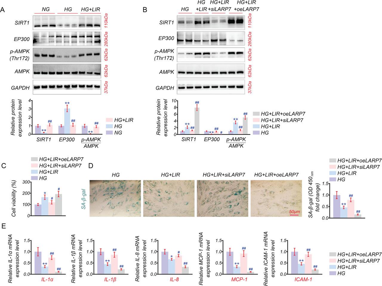 LIR regulates EC senescence through the LARP7/SIRT1 pathway. Cells were initially segregated into NG, HG, and HG + LIR groups. (A) Western blot analysis for alterations in the known senescence signaling axes, focusing on SIRT1, EP300, p-AMPK (Thr172), and AMPK. Subsequent assessments in the HG, HG + LIR, HG + LIR + siLARP7, and HG + LIR + oeLARP7 groups were conducted to determine the effects on the senescence signaling axis and cellular phenotype. **p < 0.01 vs. NG, ##p < 0.01 vs. HG. (B) Western blot analysis for SIRT1, EP300, p-AMPK (Thr172), and AMPK. (C) CCK-8 assay for evaluating cell viability. (D) SA-β-gal staining to determine cellular senescence. (E) qPCR to measure SASP gene expression levels of IL-1α, IL-1β, IL-8, MCP-1, and ICAM-1. n = 3 for each group. Scale bar: 50 μM. *p < 0.05, **p < 0.01 vs. HG, #p < 0.05, ##p < 0.01 vs. HG + LIR. EC, endothelial cell; HG, high glucose; LIR, Liraglutide; MCP-1, motif chemokine ligand 2; SASP, senescence-associated secretory phenotype.