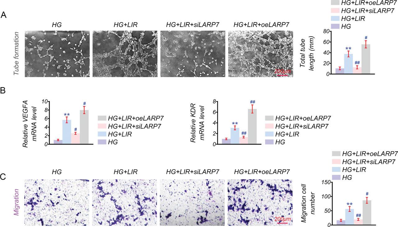 LIR restores endothelial function impaired by LARP7 deficiency. Further investigation into the impact of LIR and LARP7 on HUVEC function was conducted in the HG, HG + LIR, HG + LIR + siLARP7, and HG + LIR + oeLARP7 groups. (A) Tube formation assay to measure angiogenic capacity. (B) qPCR is used to evaluate mRNA changes in VEGFA and KDR. (C) Transwell assay for assessing HUVEC migration capabilities. n = 3 for each group. Scale bar: 200 μM. **p < 0.01 vs. HG, #p < 0.05, ##p < 0.01 vs. HG + LIR. HG, high glucose; HUVECs, human umbilical vein endothelial cells; KDR, kinase insert domain receptor; LIR, Liraglutide; VEGFA, vascular endothelial growth factor A.