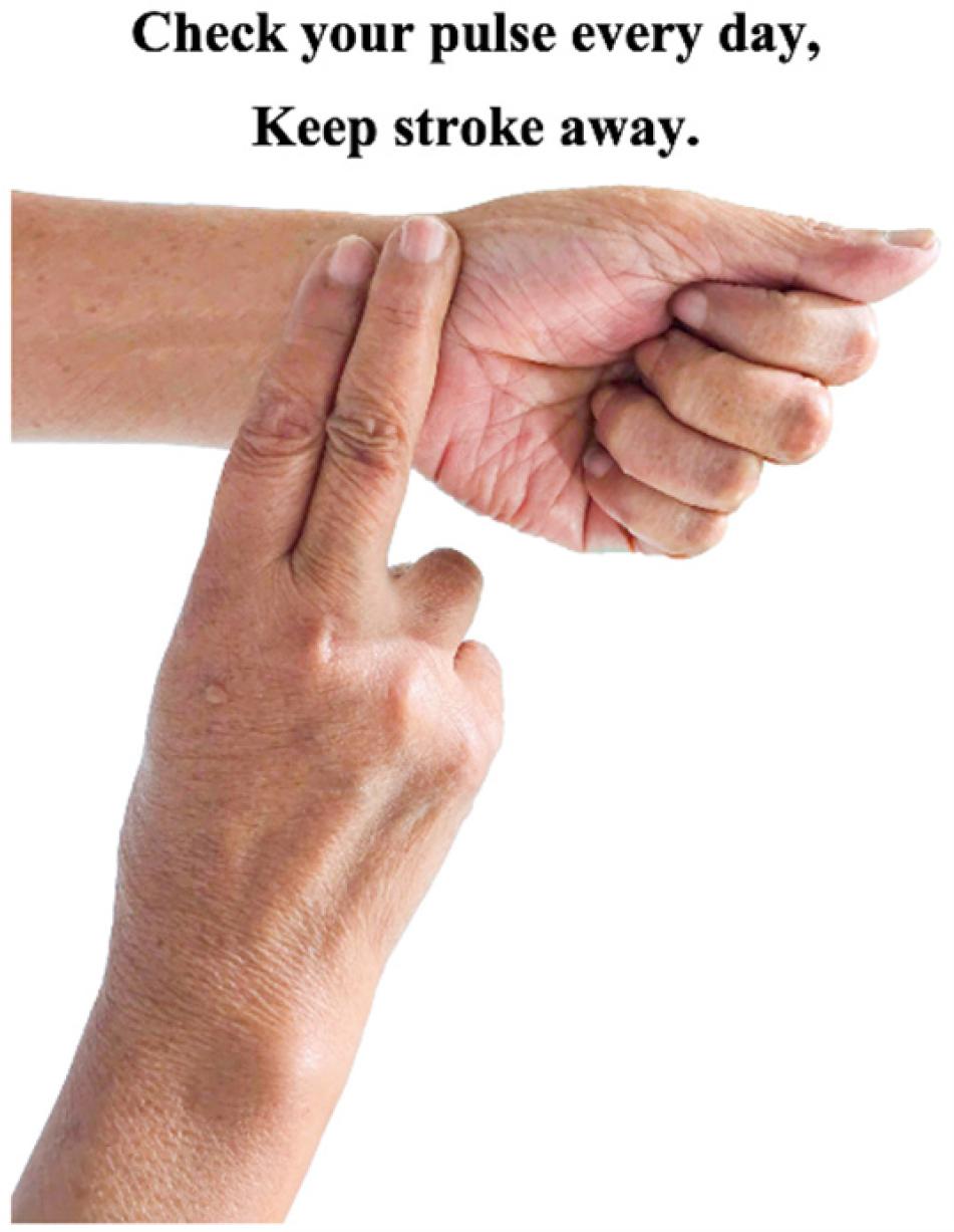 Illustration of the pulse palpation method for AF screening.